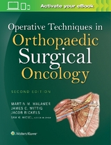 Operative Techniques in Orthopaedic Surgical Oncology - Malawer, Martin M.; Bickels, Dr. Jacob; Wittig, Dr. James C