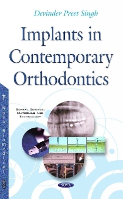 Implants in Contemporary Orthodontics - Dr Devinder Preet