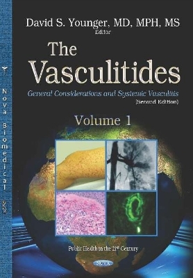 The Vasculitides - 