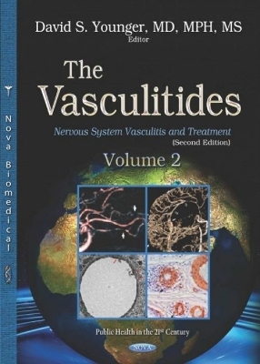 The Vasculitides - 