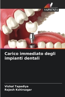 Carico immediato degli impianti dentali - Vishal Tapadiya, Rajesh Kshirsagar