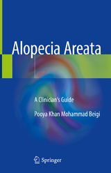 Alopecia Areata - Pooya Khan Mohammad Beigi