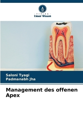 Management des offenen Apex - Saloni Tyagi, Padmanabh Jha