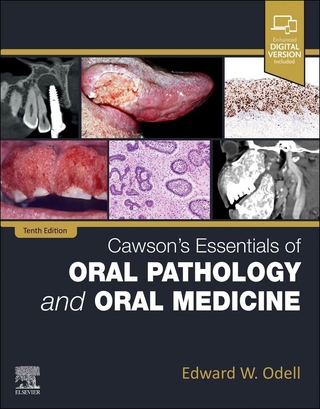 Cawson's Essentials of Oral Pathology and Oral Medicine - Edward W Odell