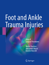 Foot and Ankle Trauma Injuries - Walter Daghino, Alessandro Massè, Daniele Marcolli
