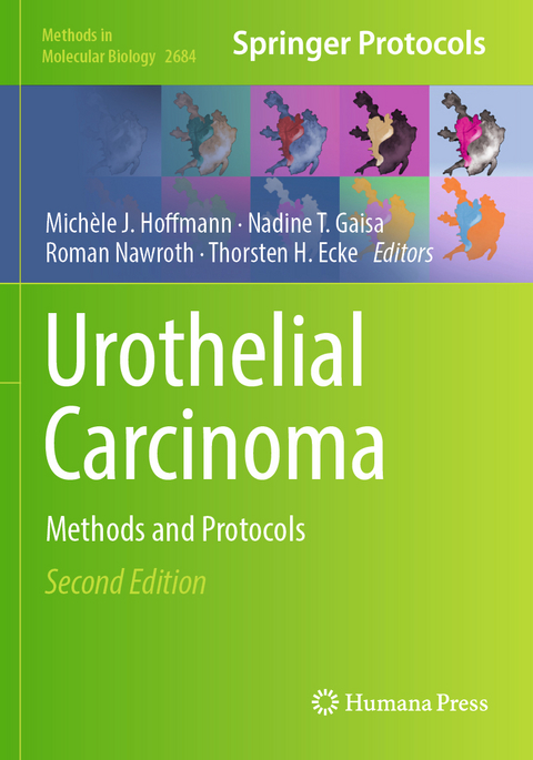 Urothelial Carcinoma - 