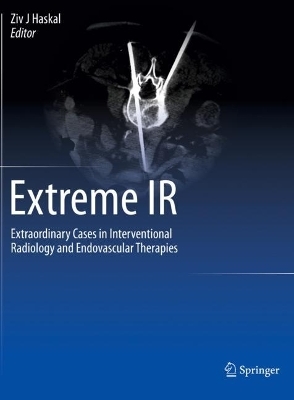 Extreme IR - 