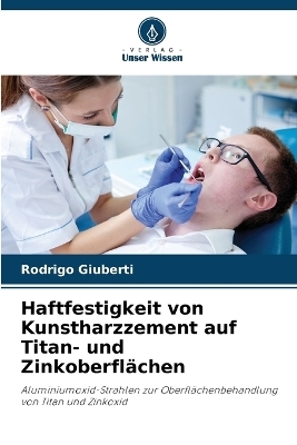 Haftfestigkeit von Kunstharzzement auf Titan- und Zinkoberfl�chen - Rodrigo Giuberti