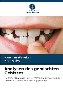 Analysen des gemischten Gebisses - Kanchan Wadekar, Nitin Gulve