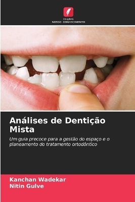 An�lises de Denti��o Mista - Kanchan Wadekar, Nitin Gulve