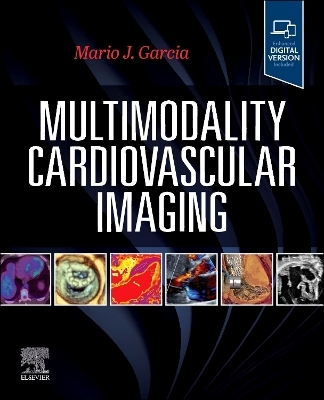 Multimodality Cardiovascular Imaging - 