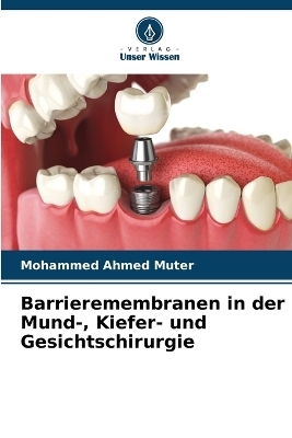 Barrieremembranen in der Mund-, Kiefer- und Gesichtschirurgie - Mohammed Ahmed Muter