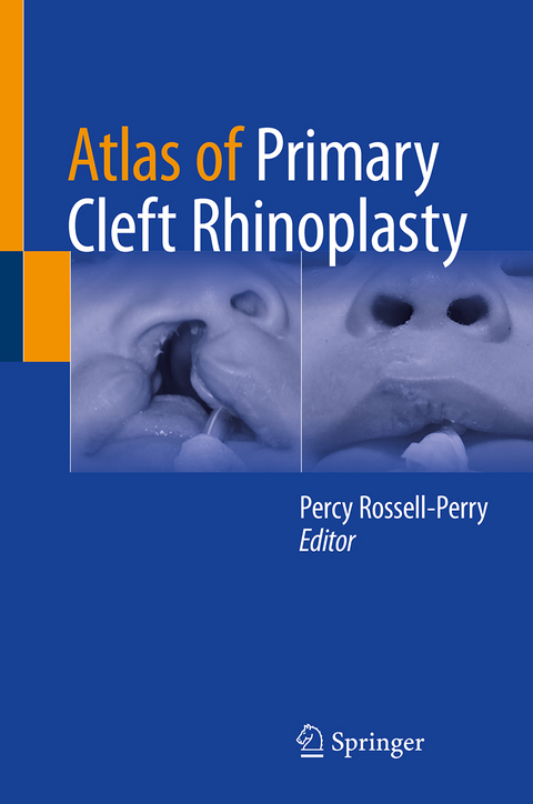 Atlas of Primary Cleft Rhinoplasty - 