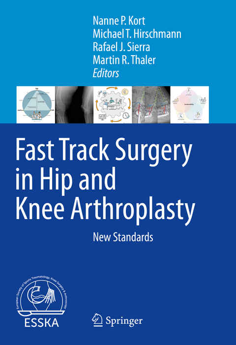 Fast Track Surgery in Hip and Knee Arthroplasty - 