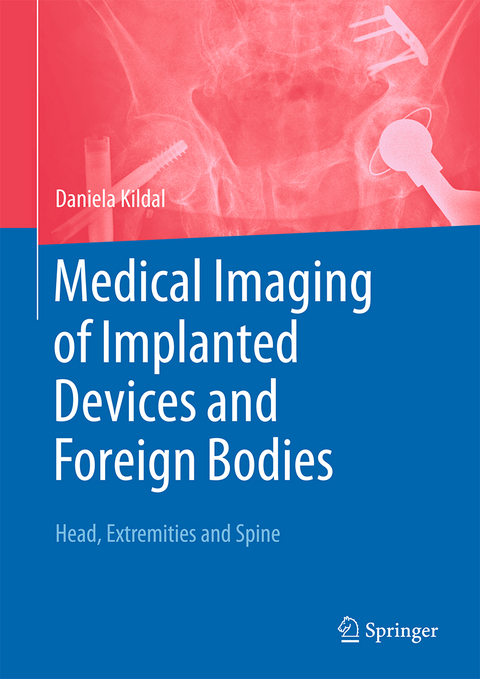 Medical Imaging of Implanted Devices and Foreign Bodies - 