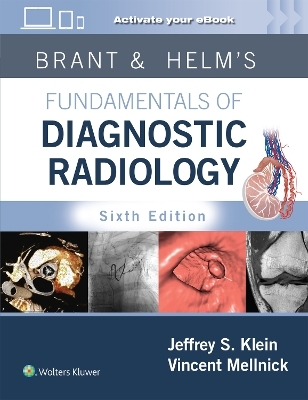 Brant & Helm's Fundamentals of Diagnostic Radiology: Print + eBook with Multimedia - Jeffrey Klein, Vincent Mellnick