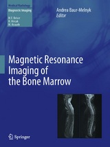 Magnetic Resonance Imaging of the Bone Marrow - 