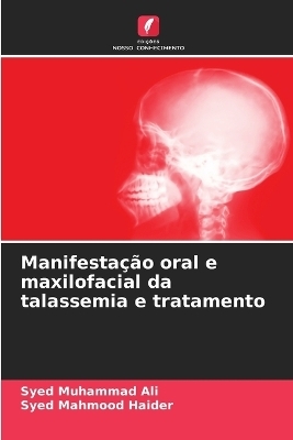 Manifestação oral e maxilofacial da talassemia e tratamento - Syed Muhammad Ali, Syed Mahmood Haider