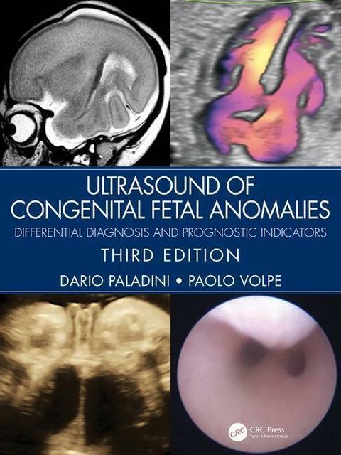 Ultrasound of Congenital Fetal Anomalies - Dario Paladini, Paolo Volpe