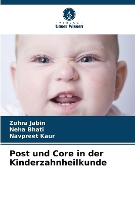 Post und Core in der Kinderzahnheilkunde - Zohra Jabin, Neha Bhati, Navpreet Kaur