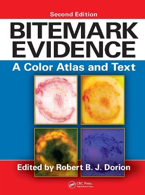 Bitemark Evidence - 