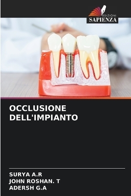 Occlusione Dell'impianto - Surya A R, John Roshan T, Adersh G a