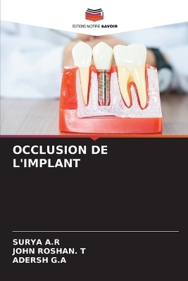 Occlusion de l'Implant - Surya A R, John Roshan T, Adersh G a