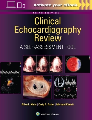 Clinical Echocardiography Review - 