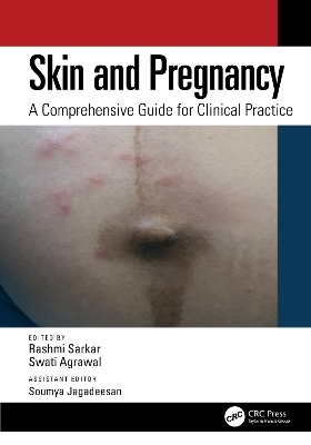 Skin and Pregnancy - 