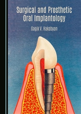 Surgical and Prosthetic Oral Implantology - Gagik V. Hakobyan