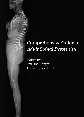 Comprehensive Guide to Adult Spinal Deformity - 