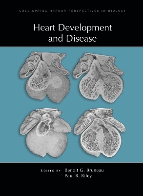 Heart Development and Disease - 