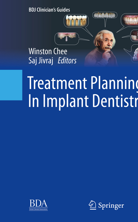 Treatment Planning In Implant Dentistry - 