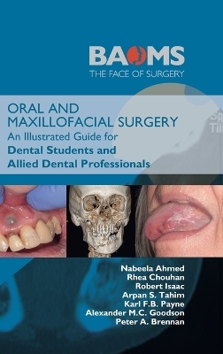 Oral and Maxillofacial Surgery - Nabeela Ahmed, Rhea Chouhan, Robert Isaac