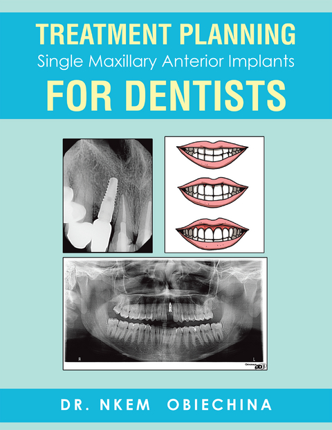 Treatment Planning Single Maxillary Anterior Implants for Dentists - Dr. Nkem Obiechina