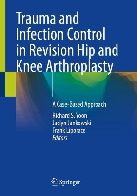 Trauma and Infection Control in Revision Hip and Knee Arthroplasty - 