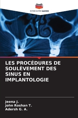 Les Procédures de Soulèvement Des Sinus En Implantologie - Jeena J, John Roshan T, Adersh G a