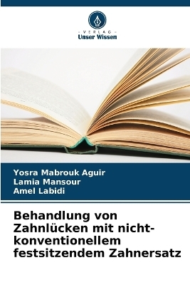 Behandlung von Zahnlücken mit nicht-konventionellem festsitzendem Zahnersatz - Yosra Mabrouk Aguir, Lamia Mansour, Amel Labidi