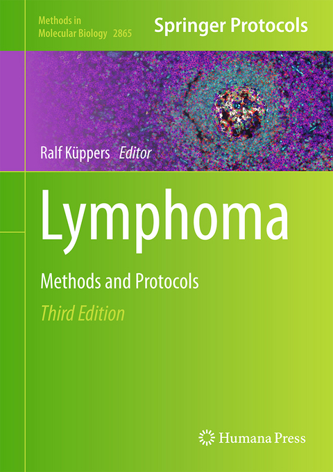 Lymphoma - 