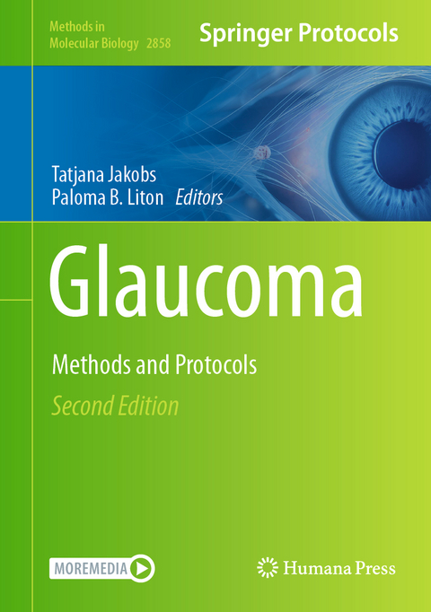 Glaucoma - 