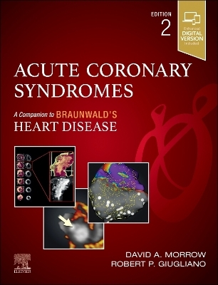 Acute Coronary Syndromes - 