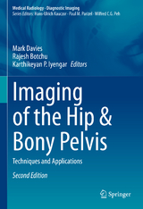 Imaging of the Hip & Bony Pelvis - Davies, Mark; Botchu, Rajesh; Iyengar, Karthikeyan. P.