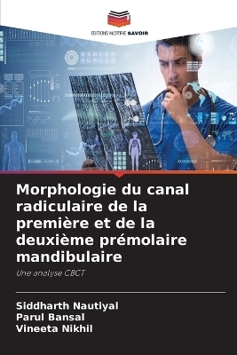 Morphologie du canal radiculaire de la première et de la deuxième prémolaire mandibulaire - Siddharth Nautiyal, Parul Bansal, Vineeta Nikhil