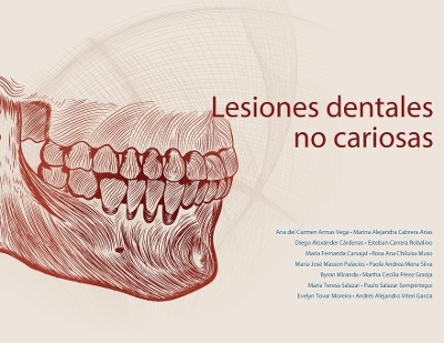 Lesiones dentales no cariosas - Ana del Carmen Armas Vega