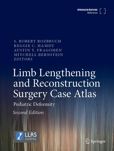 Limb Lengthening and Reconstruction Surgery Case Atlas - 