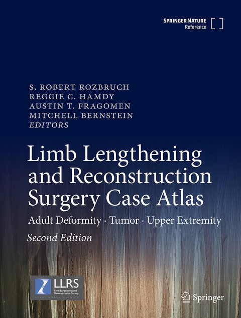 Limb Lengthening and Reconstruction Surgery Case Atlas - 