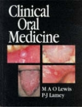 Clinical Oral Medicine - Lewis, Michael A. O.; Lamey, Philip-John