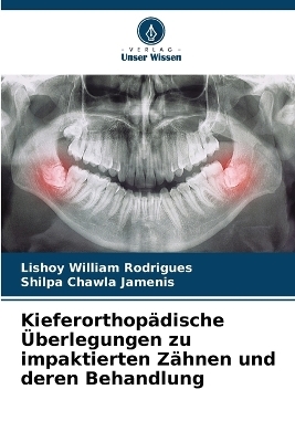 Kieferorthopädische Überlegungen zu impaktierten Zähnen und deren Behandlung - Lishoy William Rodrigues, Shilpa Chawla Jamenis