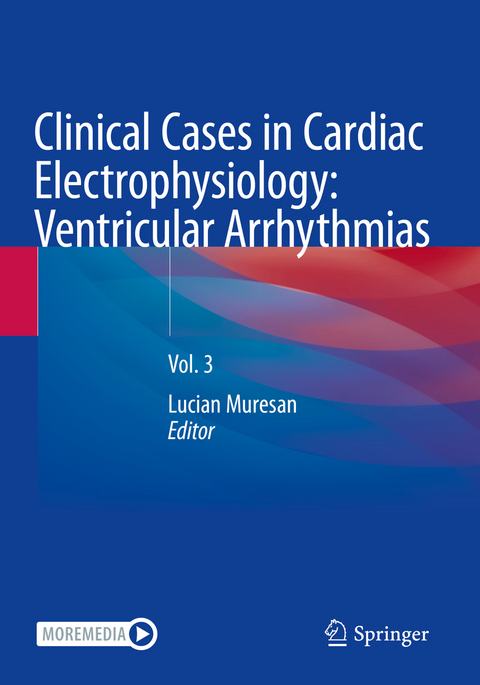 Clinical Cases in Cardiac Electrophysiology: Ventricular Arrhythmias - 