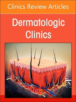 Hidradenitis Suppurativa, An Issue of Dermatologic Clinics - 